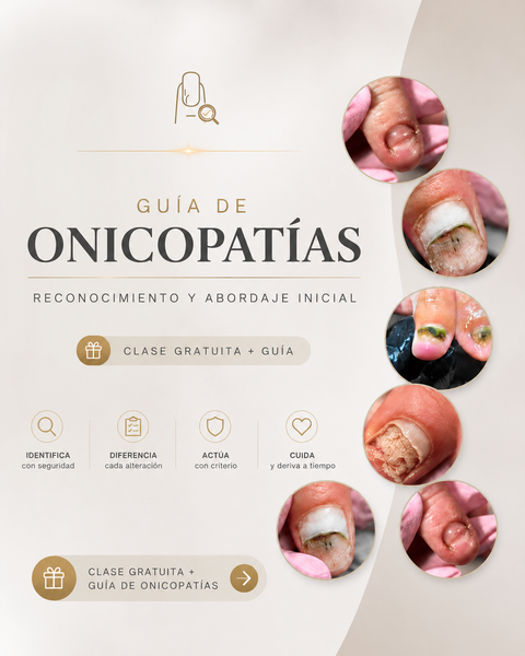 Guía DEFINITIVA de Onicopatías 