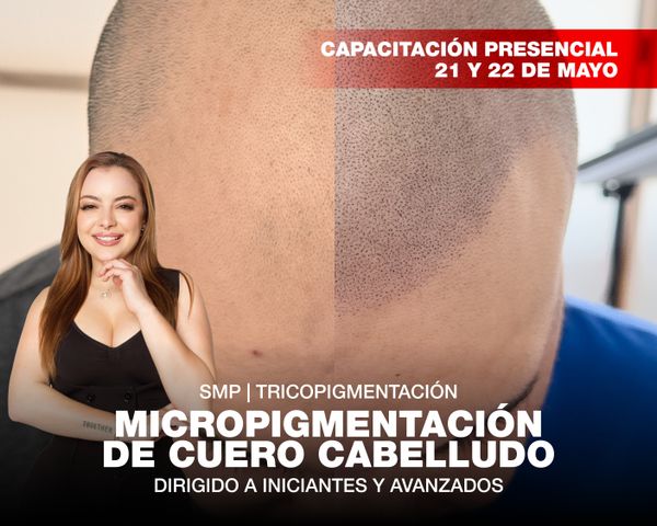 Micropigmentación de Cuero Cabelludo - Scalp Presencial 21 y 22 de Mayo