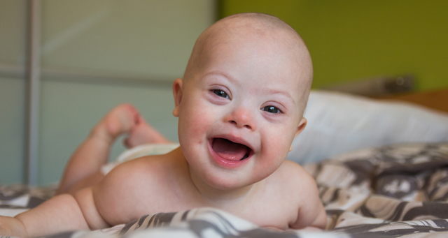 Nutrición y Lactancia Materna en Niños con Síndrome de Down