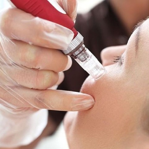 Clase Online - Dermapen