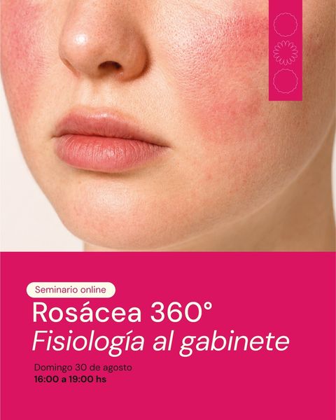 Seminario online: Rosácea 360°de la fisiología al gabinete