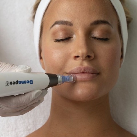 Clases online: Dermapen y Dermapen Superior