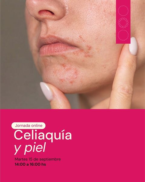 Jornada online: Celiaquía y Piel