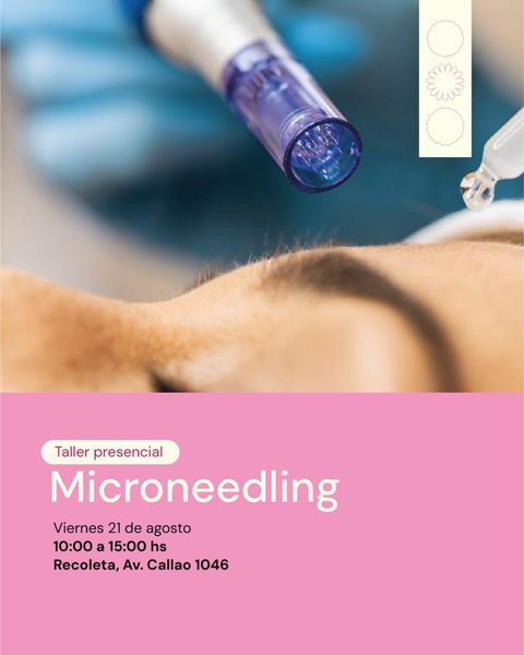 Taller Presencial de Microneedling Profesional