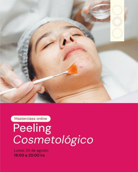 Masterclass online: Peeling cosmetológico