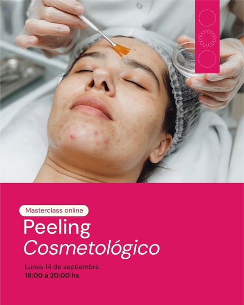 Masterclass online: Peeling cosmetológico