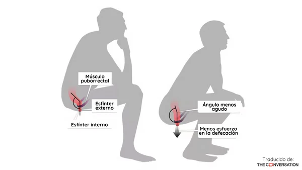 ¿Por qué debes defecar en cuclillas?