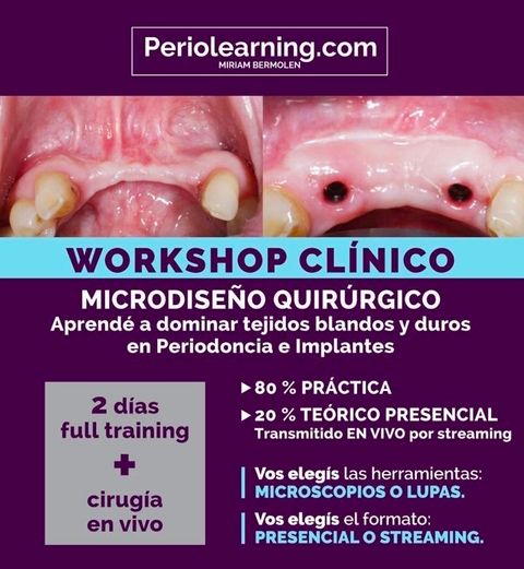 Microdiseño Quirúrgico. Soluciones quirúrgicas para la clínica diaria.