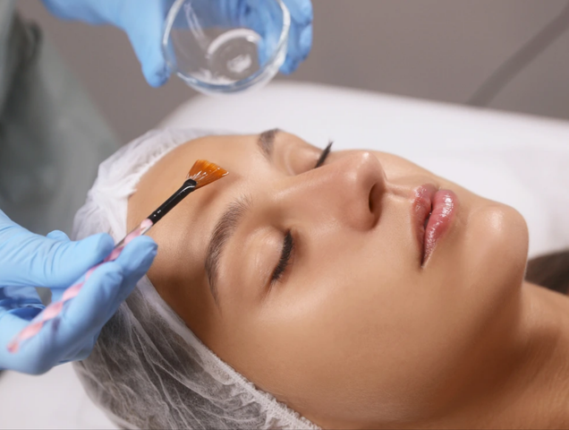 Curso de Peeling Profesional