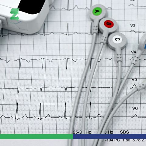 Electrocardiograma